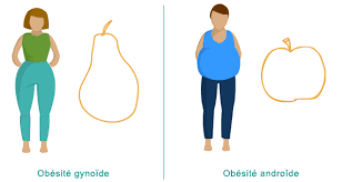 Forme de l'obésité.png