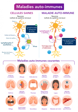 Maladies auto-immunes.png