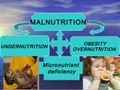 Malnutrition-soniaf1.jpg