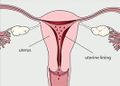 Menstruation-akremi.jpg.jpg